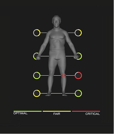 Scan